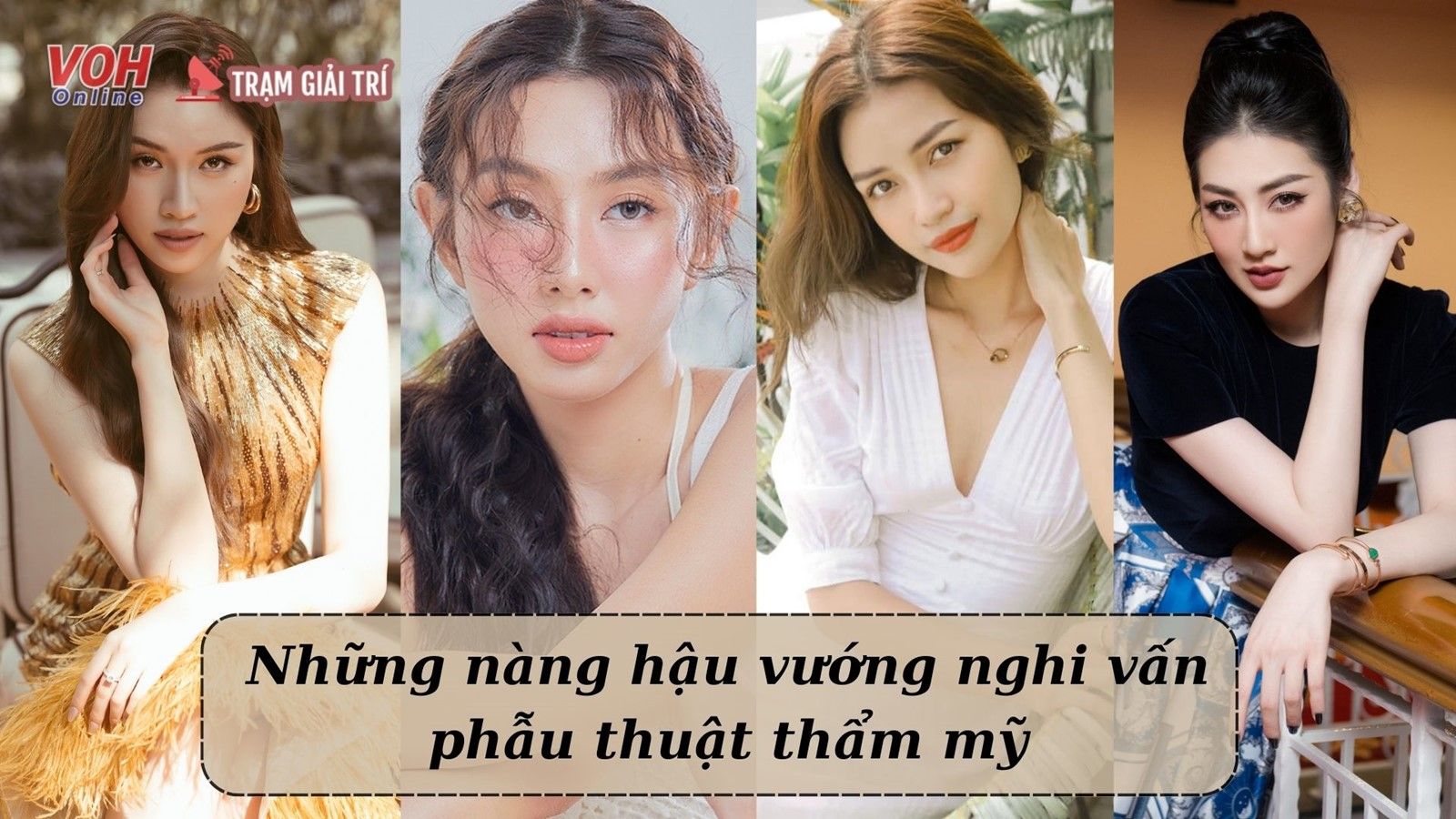 Điểm danh những mỹ nhân Vbiz vướng nghi vấn phẫu thuật thẫm mỹ