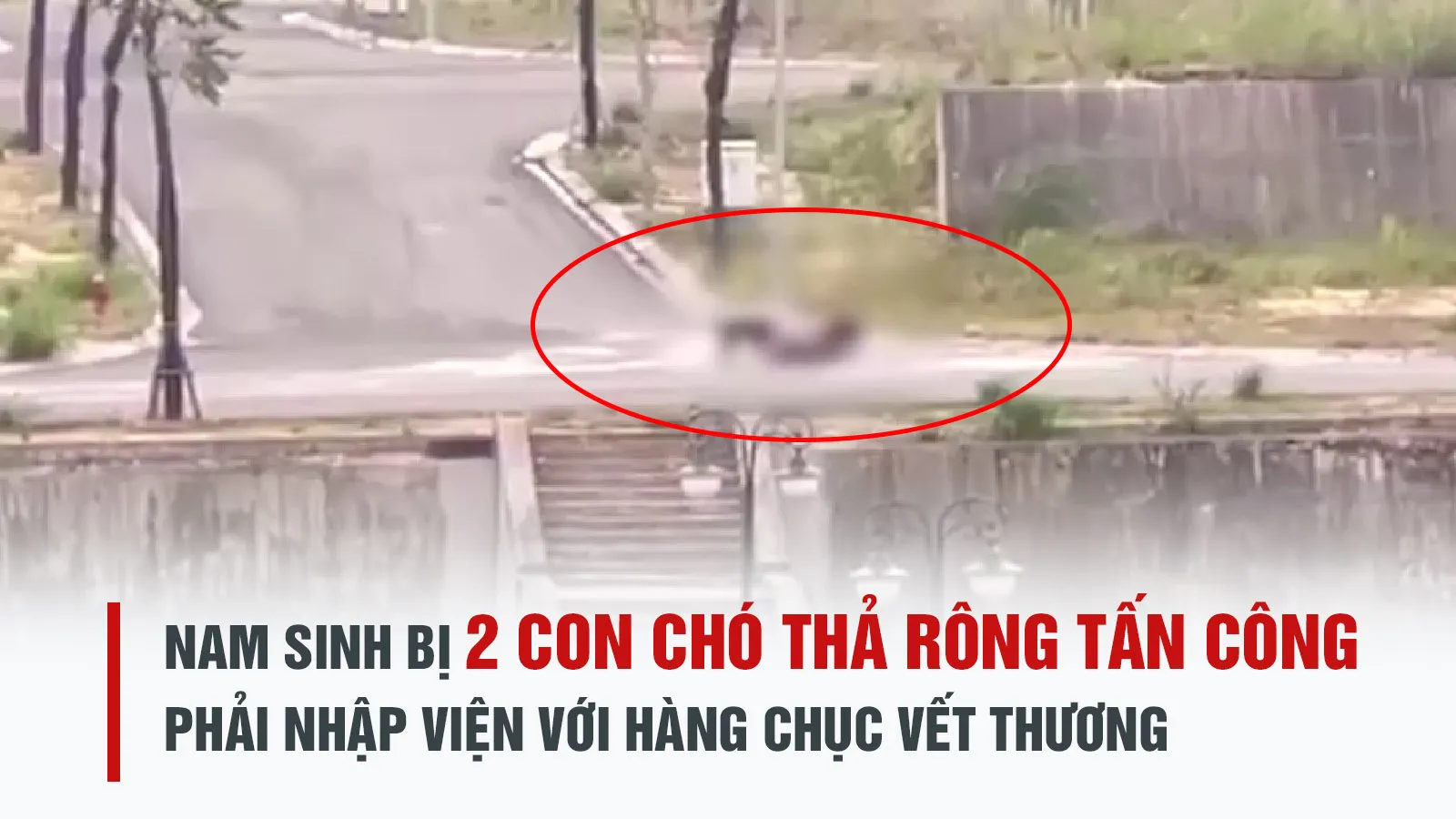 Nam sinh viên bị 2 con chó dữ cắn gây thương tích nặng