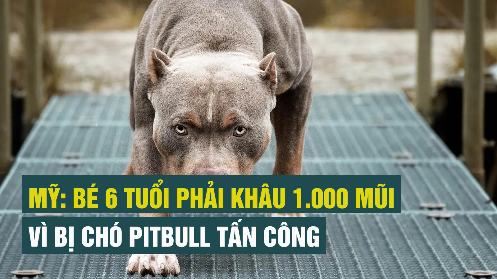 Bé gái phải khâu 1.000 mũi, không thể cười lại vì bị chó pitbull tấn công