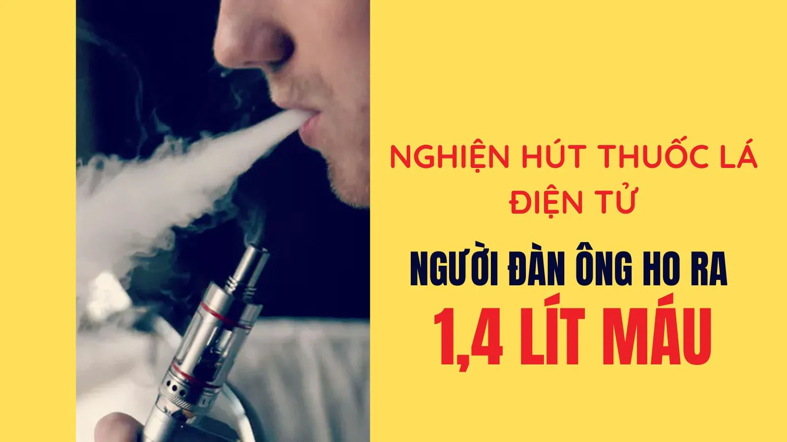 Nghiện hút thuốc lá điện tử, người đàn ông ho ra 1,4 lít máu