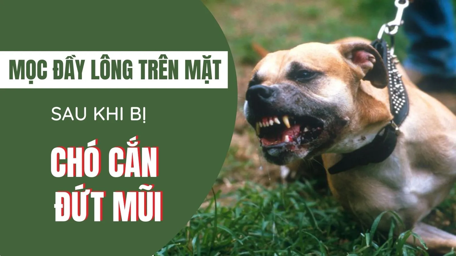 Sau khi bị chó cưng cắn đứt mũi, cô gái mọc đầy lông trên mặt