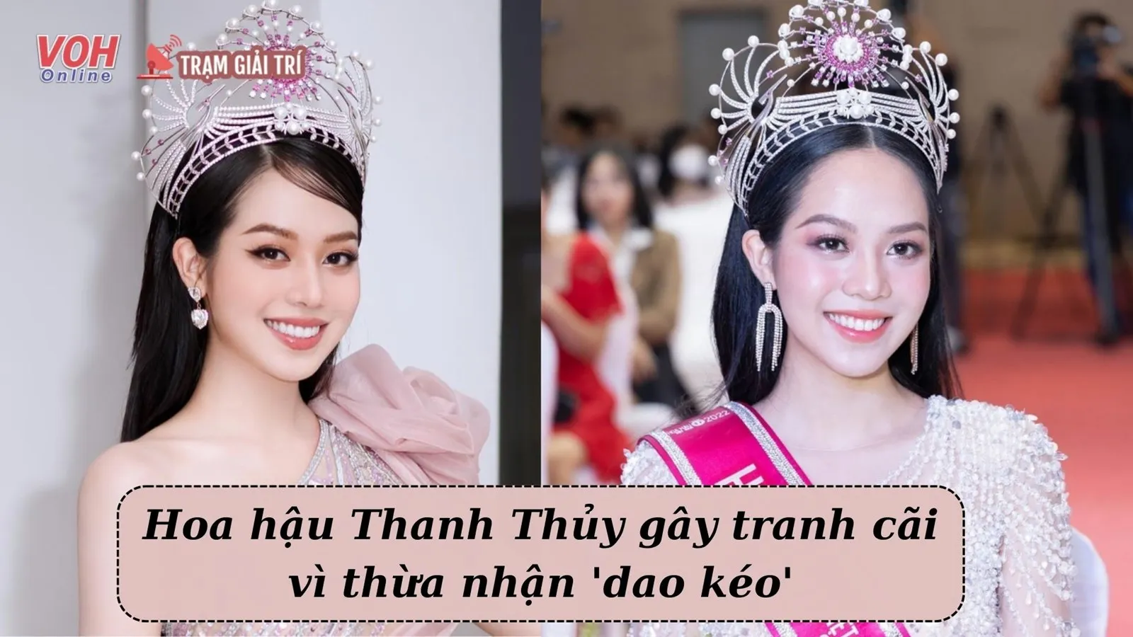 Hoa hậu Thanh Thủy thừa nhận đã đụng chạm dao kéo