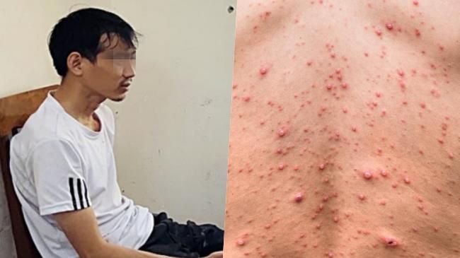 Điểm tin chiều 4/4: Chồng cũ giết vợ tại siêu thị | Nhiều người gặp biến chứng nặng do thủy đậu