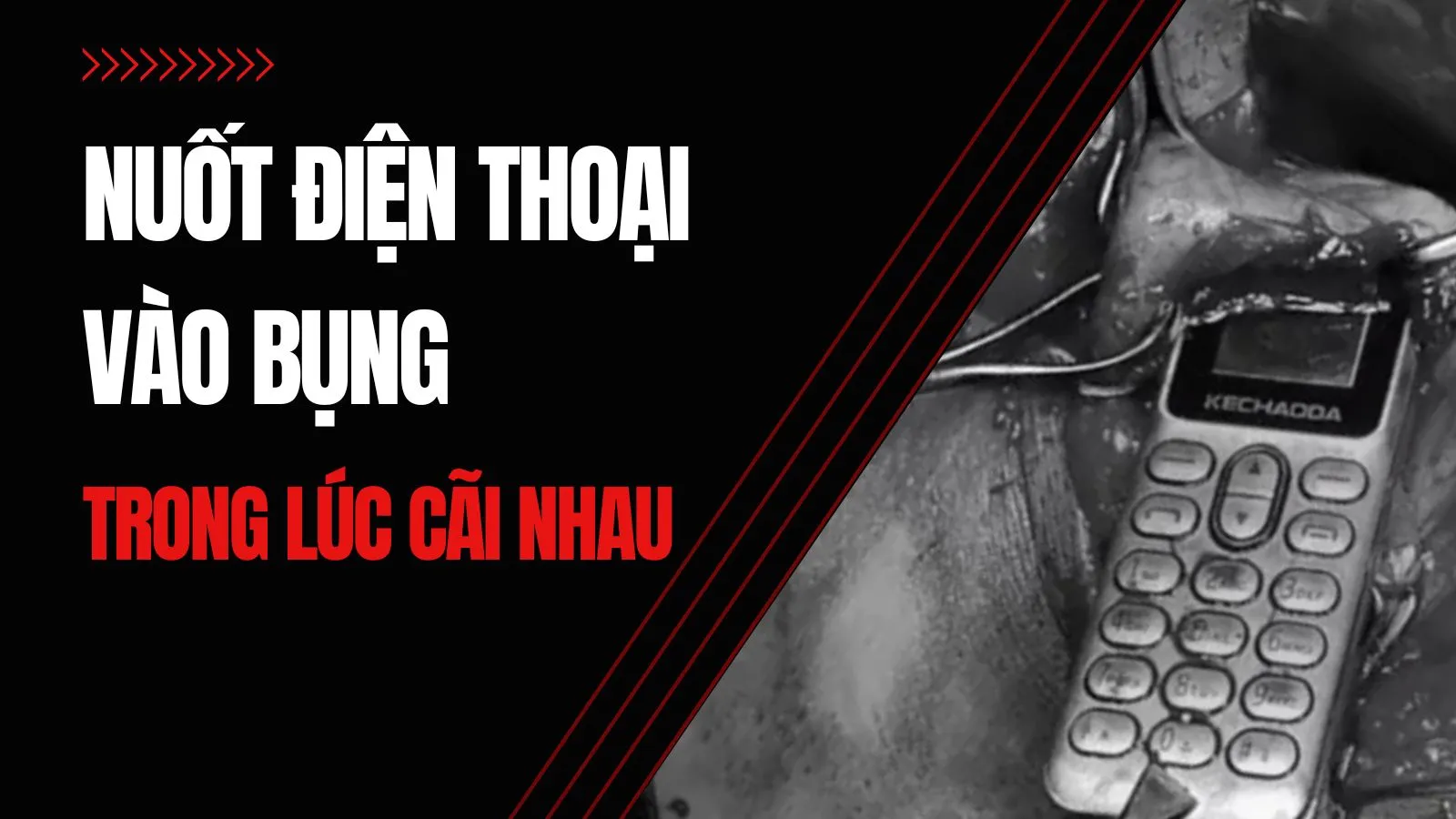 Nuốt điện thoại vào bụng trong lúc cãi nhau với em trai