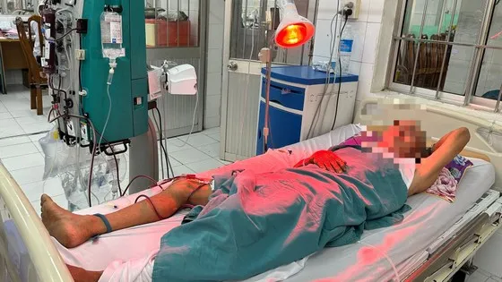 Cà Mau: Ngộ độc rượu, 1 người chết, 5 người nhập viện