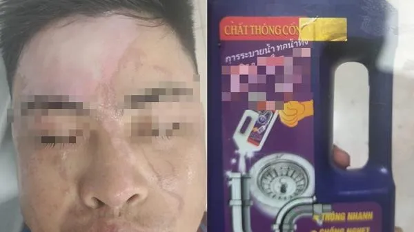 Nổ lớn khi thông cống, một người bỏng nặng