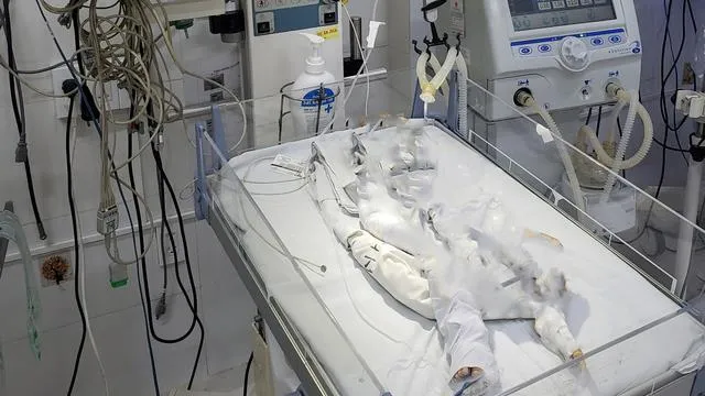 Bé gái mới hơn 2 tháng tuổi đã bị bạn mẹ đánh đến nguy kịch