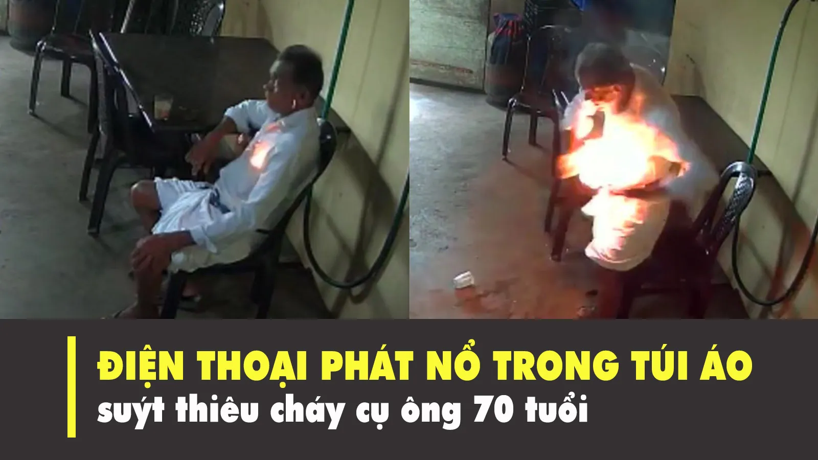 Điện thoại phát nổ trong túi áo