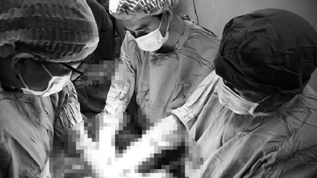 Thai phụ có chỉ số mỡ máu nguy hiểm được phẫu thuật kịp thời
