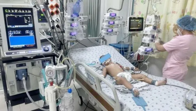 TPHCM: Có 18 trẻ mắc TCM nặng đang điều trị tại các khoa hồi sức tích cực