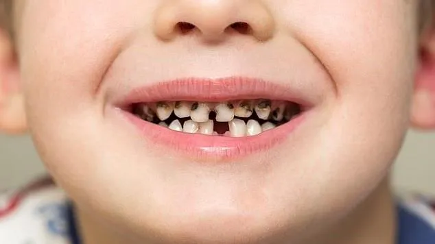 Những thói quen hàng ngày khiến bạn tự “phá” răng của mình
