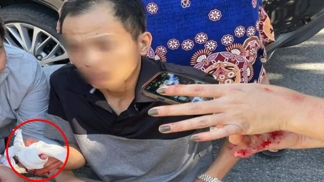 Đà Nẵng: Một người đàn ông bị chém ngay trước nhà