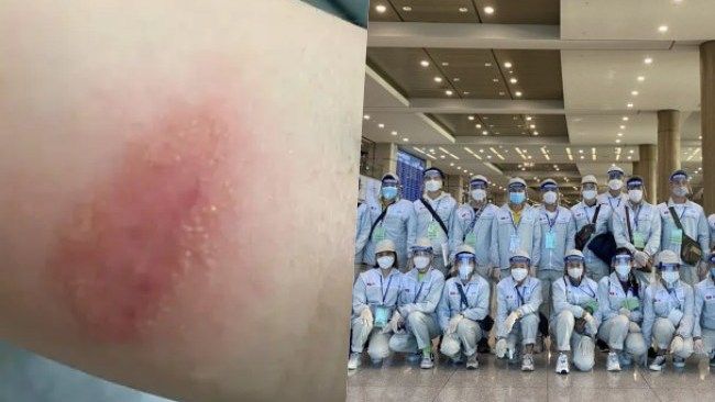 Điểm tin chiều 8/7: Cảnh giác kiến ba khoang mùa mưa | Tuyển lao động sang Hàn Quốc làm việc