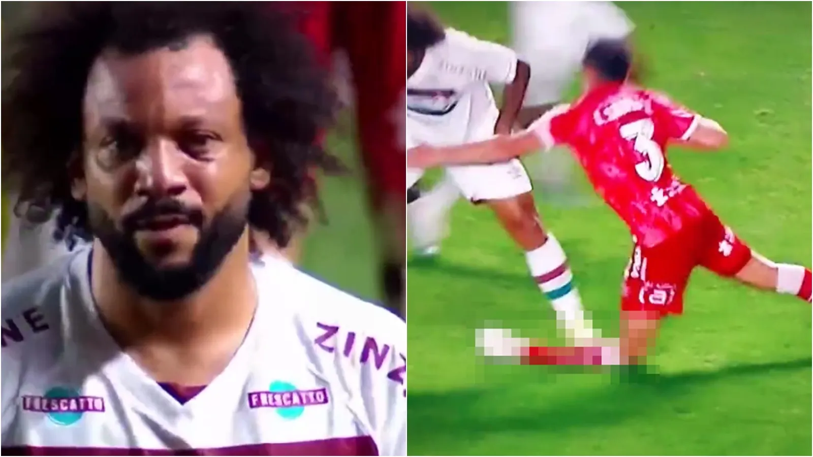 Kinh hoàng Marcelo đạp gãy chân đồng nghiệp, bật khóc ngay trên sân