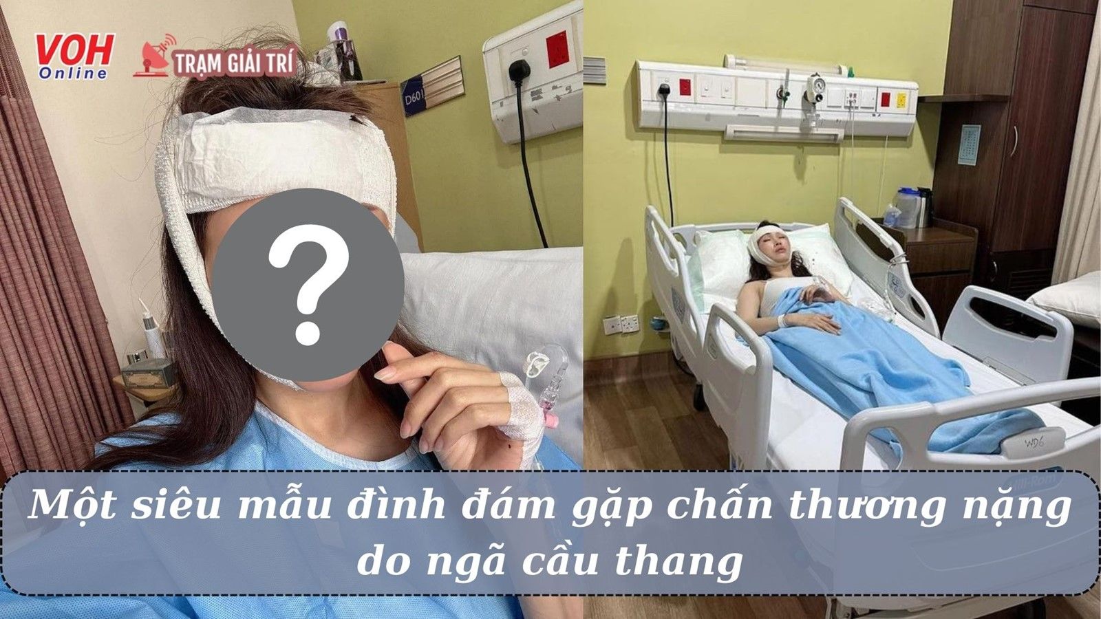 Siêu mẫu quốc tế bị ngã cầu thang đến mức phải phẫu thuật gấp trong đêm