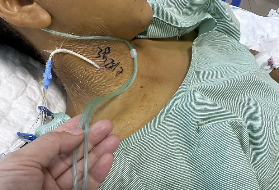 Suy đa tạng sau khi ăn xôi tím