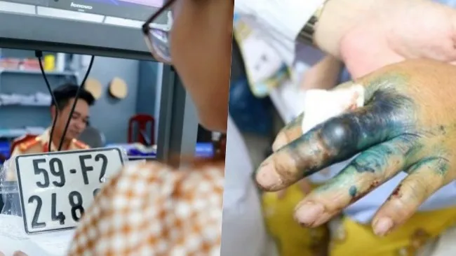 Điểm tin chiều 12/8: 8 trường hợp bị thu hồi cà vẹt xe | Nhiều trẻ bị rắn độc cắn