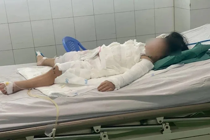 Bé 2 tuổi bỏng miệng vì uống nhầm nước tẩy bồn cầu