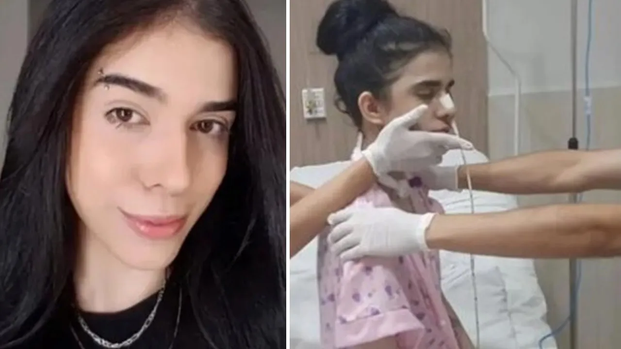 Sưng não nghiêm trọng do hít phải ớt siêu cay