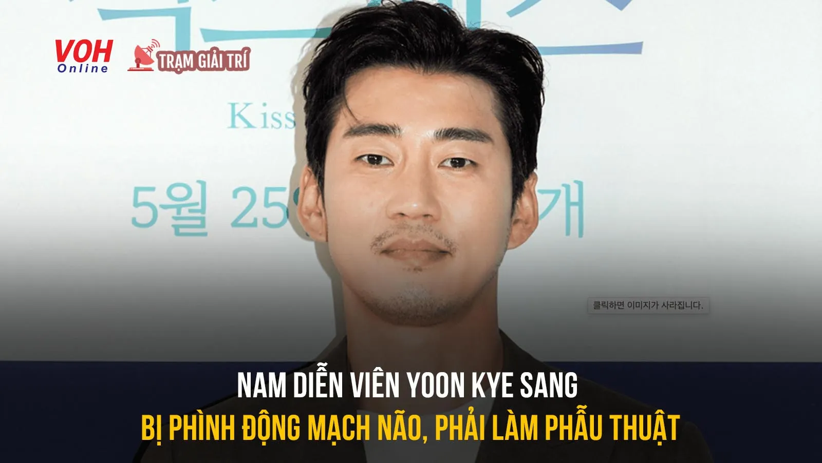 Nam diễn viên Yoon Kye Sang từng bị phình động mạch não, cuộc sống thay đổi sau phẫu thuật