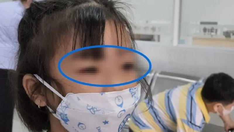 Đà Nẵng: Số ca mắc bệnh đau mắt đỏ đang tăng