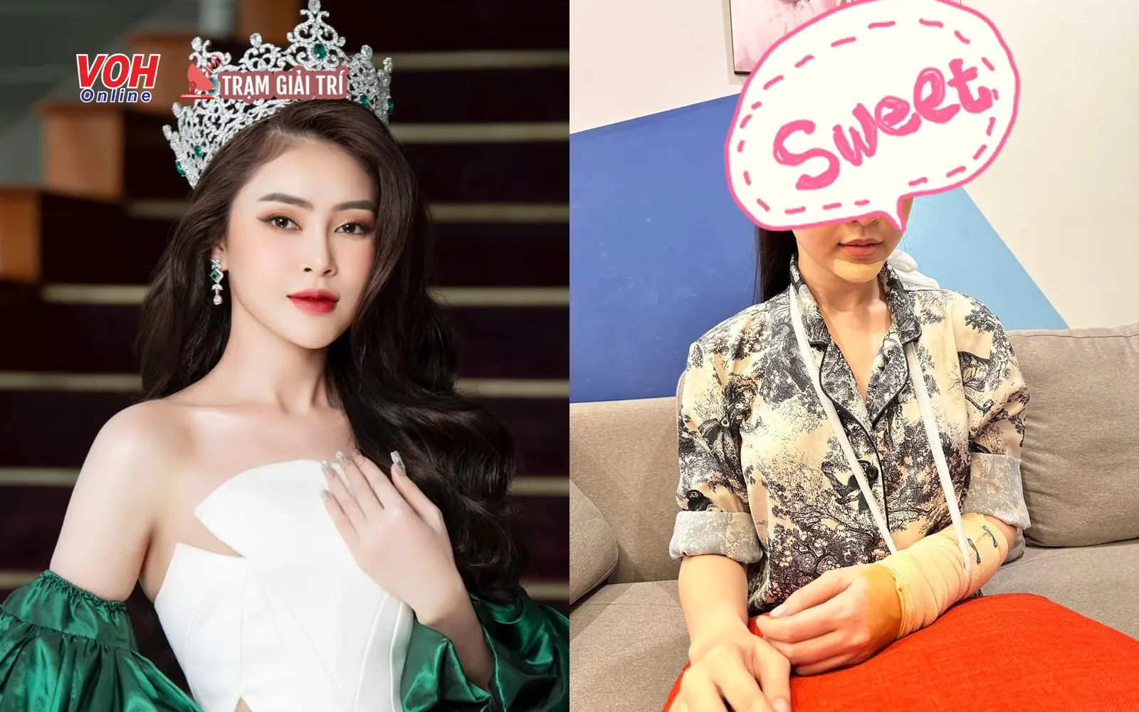 Hoa hậu Lý Kim Thảo bị tai nạn giao thông, phải rút khỏi Miss Universe Vietnam 2023 vì chấn thương