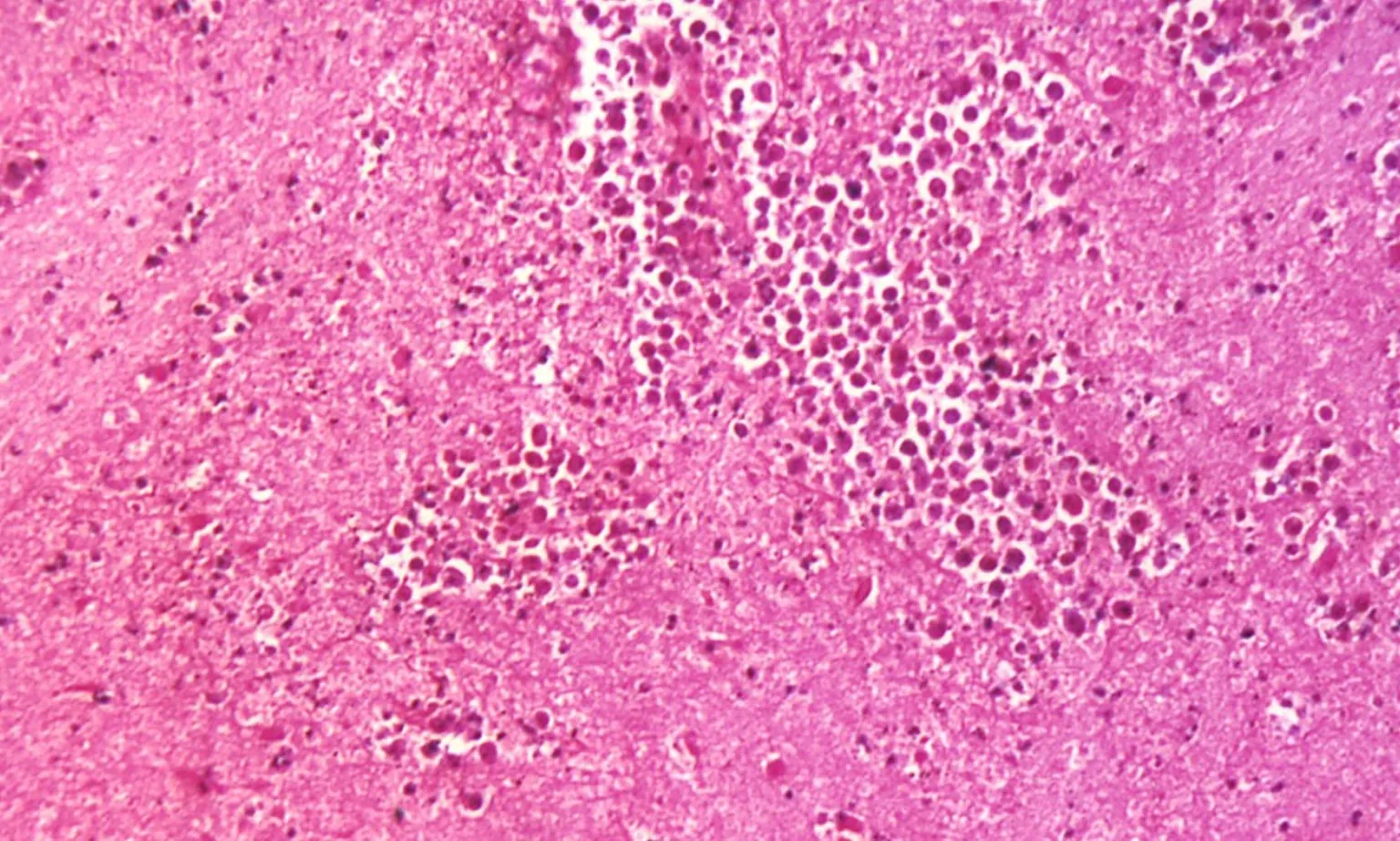 Cảnh báo nhiễm amip ăn não chết người khi bơi lội ở sông hồ