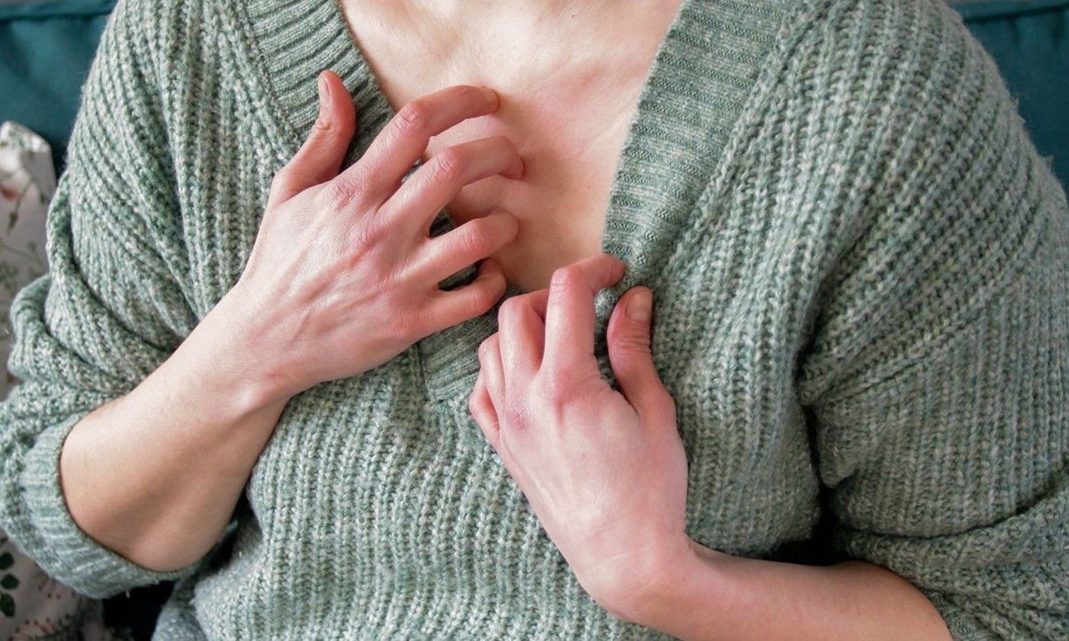 Những điều bạn nên biết về phát ban do căng thẳng