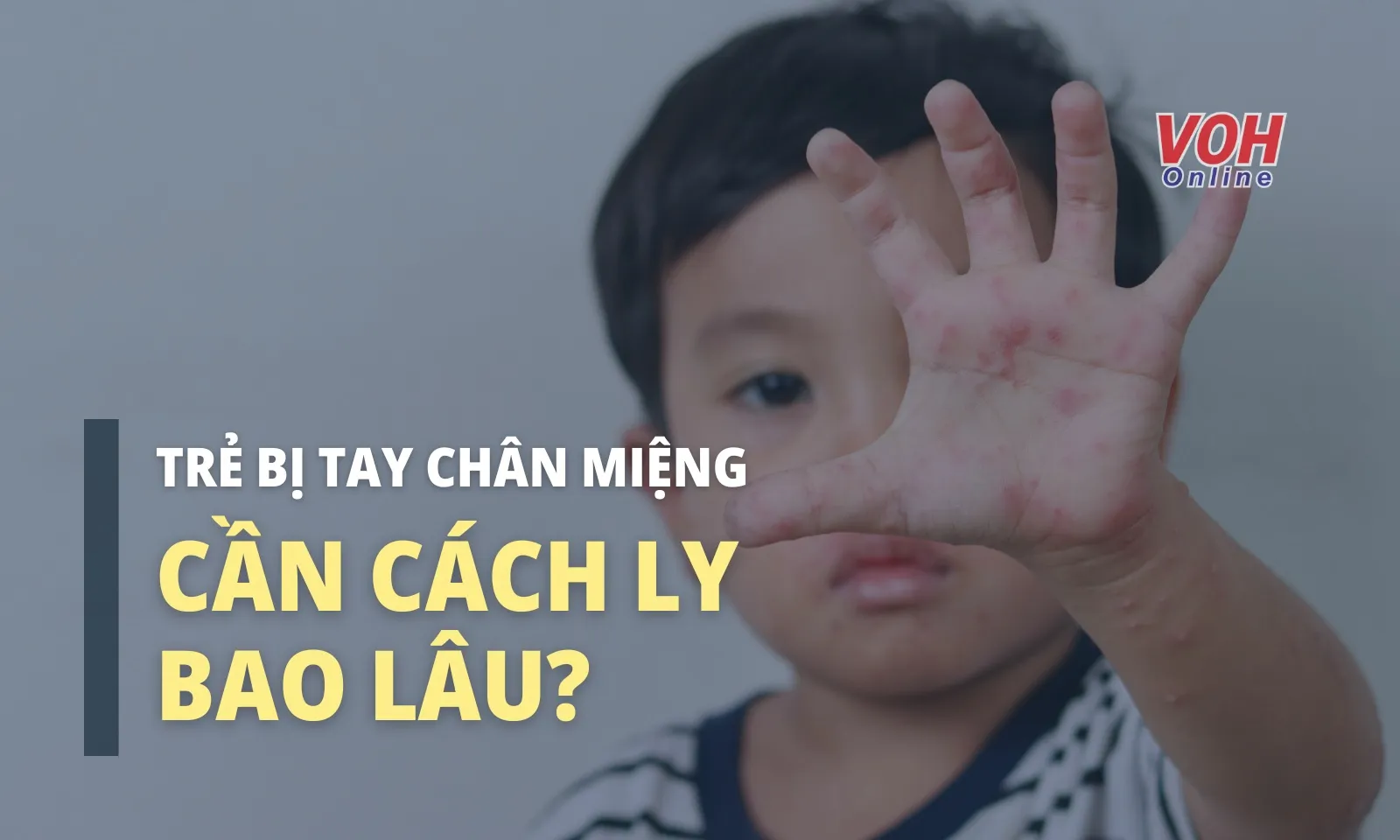 Trẻ mắc tay chân miệng phải cách ly bao lâu?