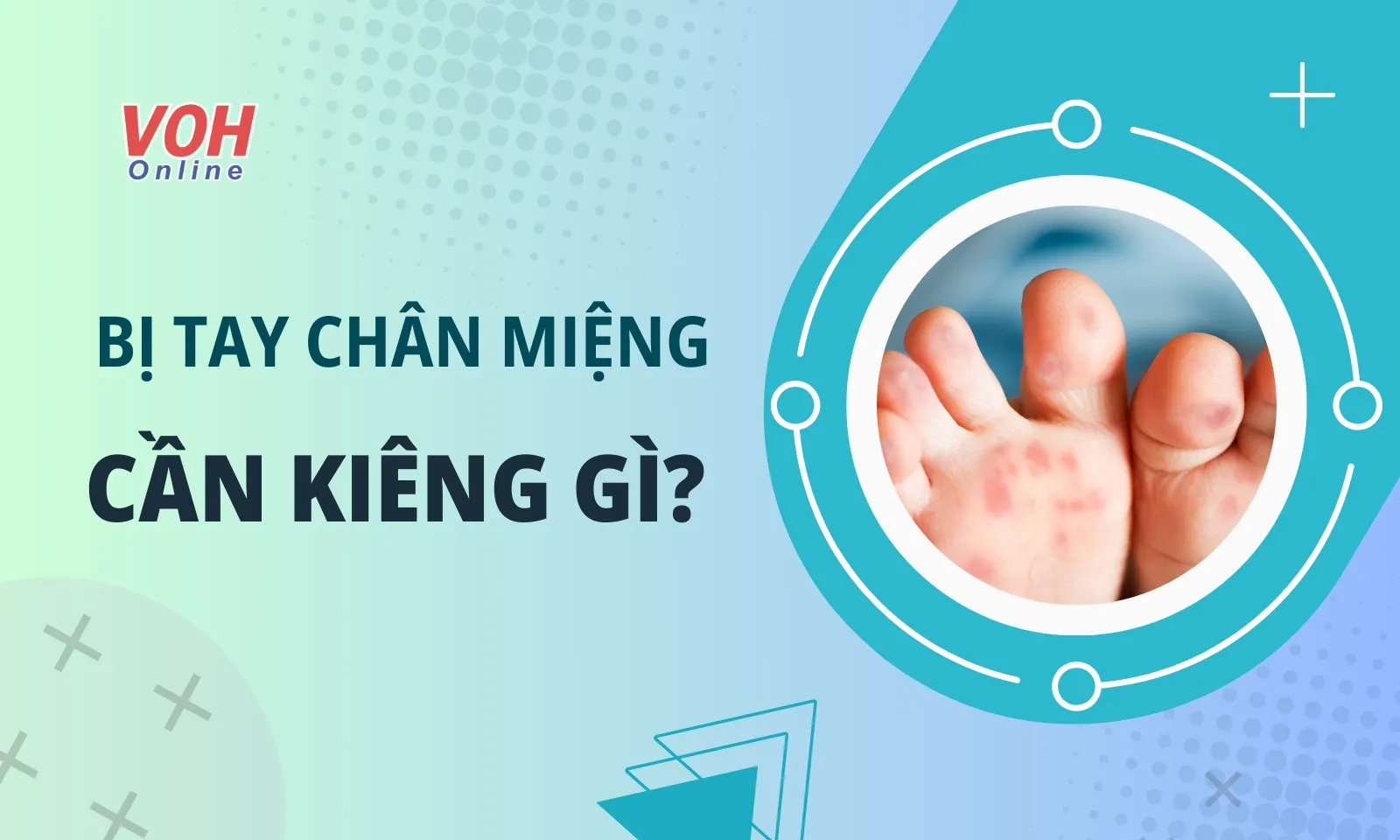 Bị tay chân miệng kiêng gì? 3 sai lầm thường gặp khiến bệnh lâu khỏi