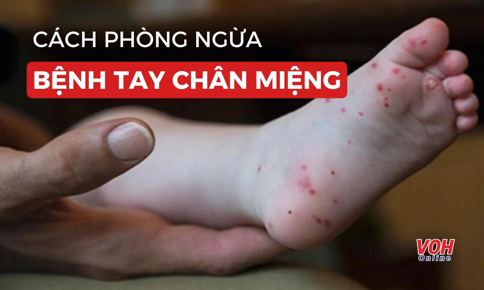 Cách phòng ngừa bệnh Tay Chân Miệng