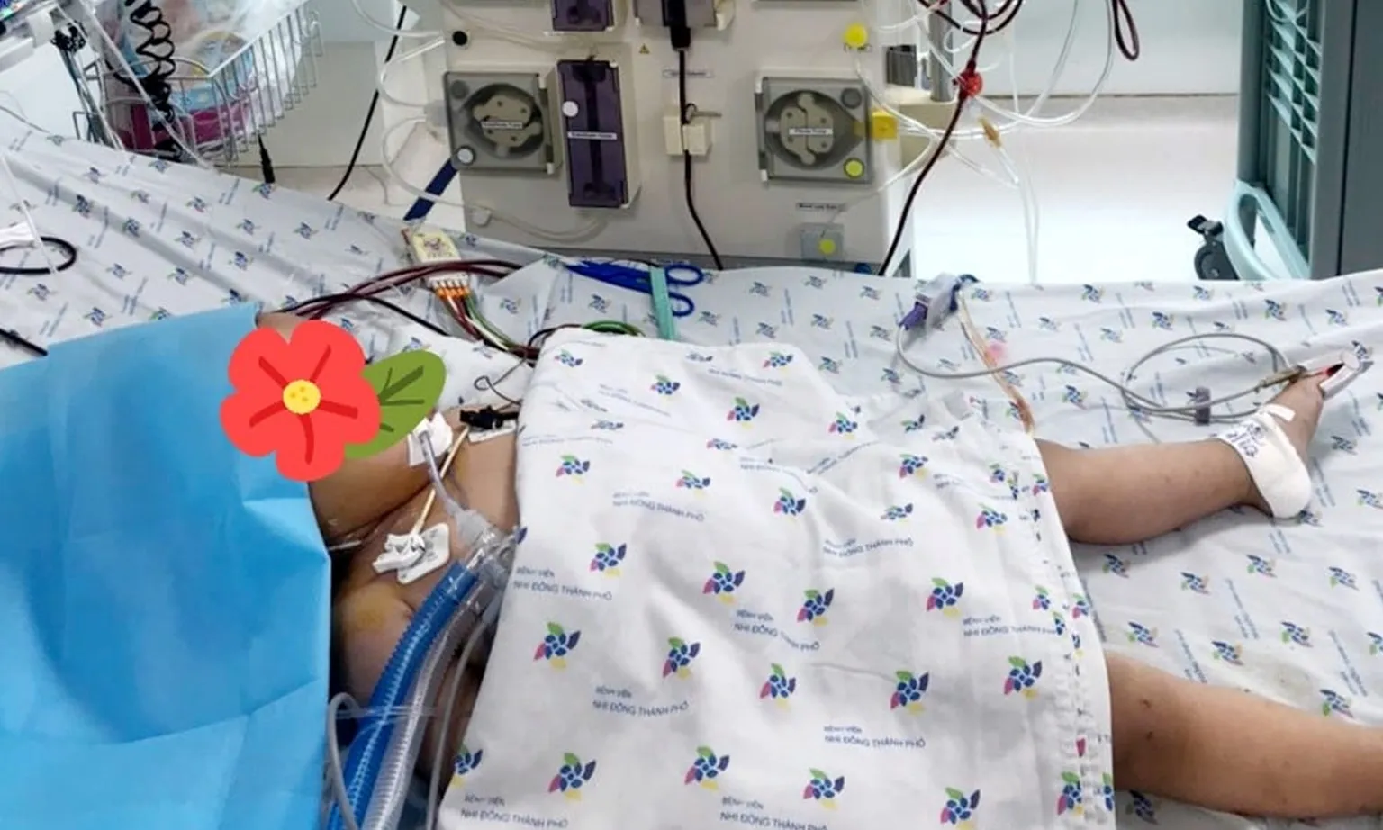 Kiên Giang: Bé trai ngộ độc dung môi trong suốt gây tổn thương tạng nặng