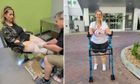 Người phụ nữ mất tứ chi do biến chứng bệnh cúm