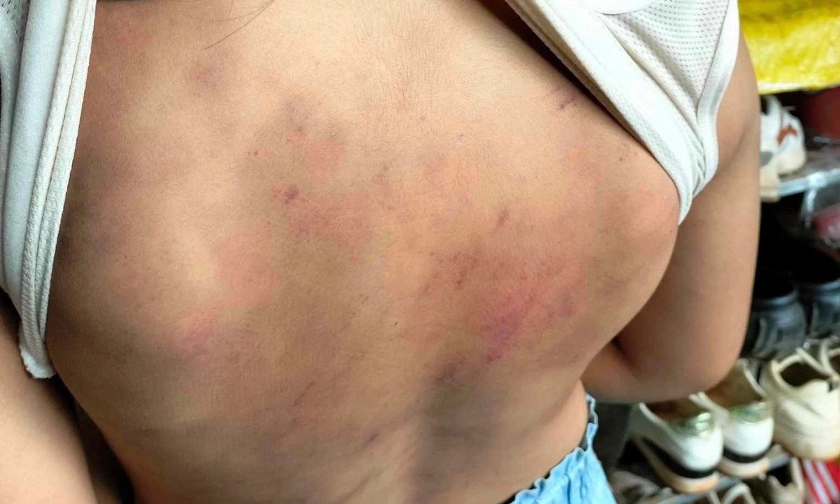 Đắk Lắk: Học sinh lớp 4 bị 10 bạn đánh hội đồng