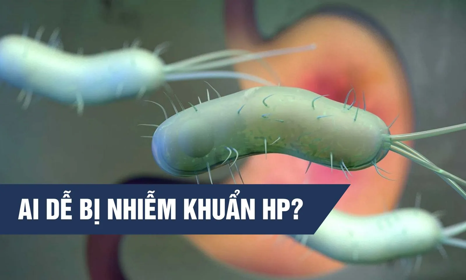 Nhóm đối tượng nào dễ bị vi khuẩn HP tấn công?