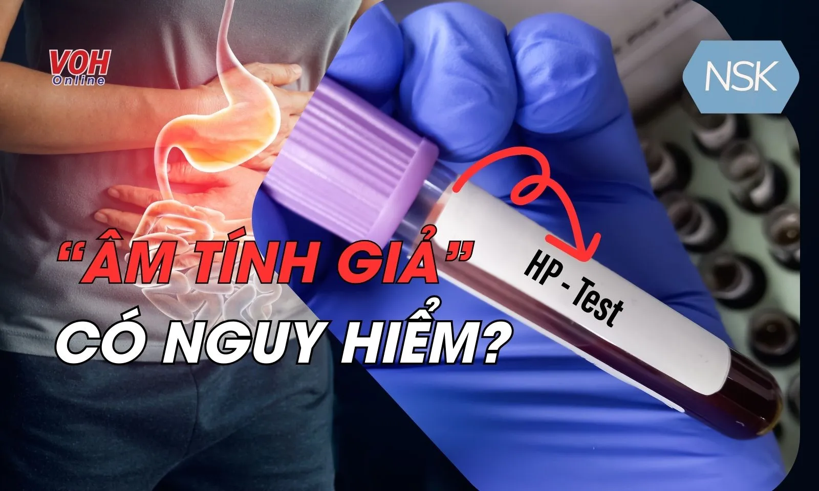 “Âm tính giả” với vi khuẩn HP nguy hiểm như thế nào?