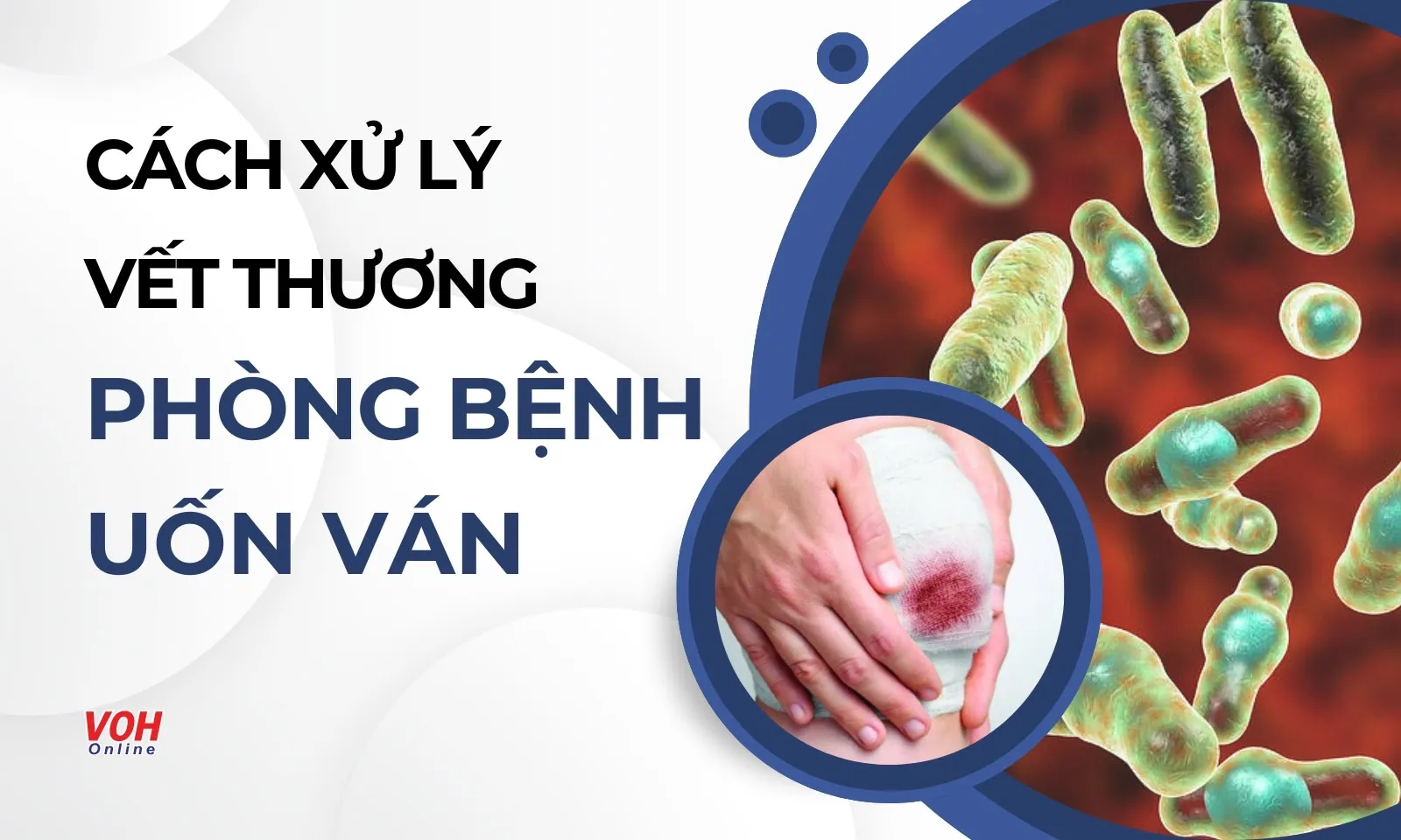 Cách xử lý vết thương để phòng bệnh Uốn ván