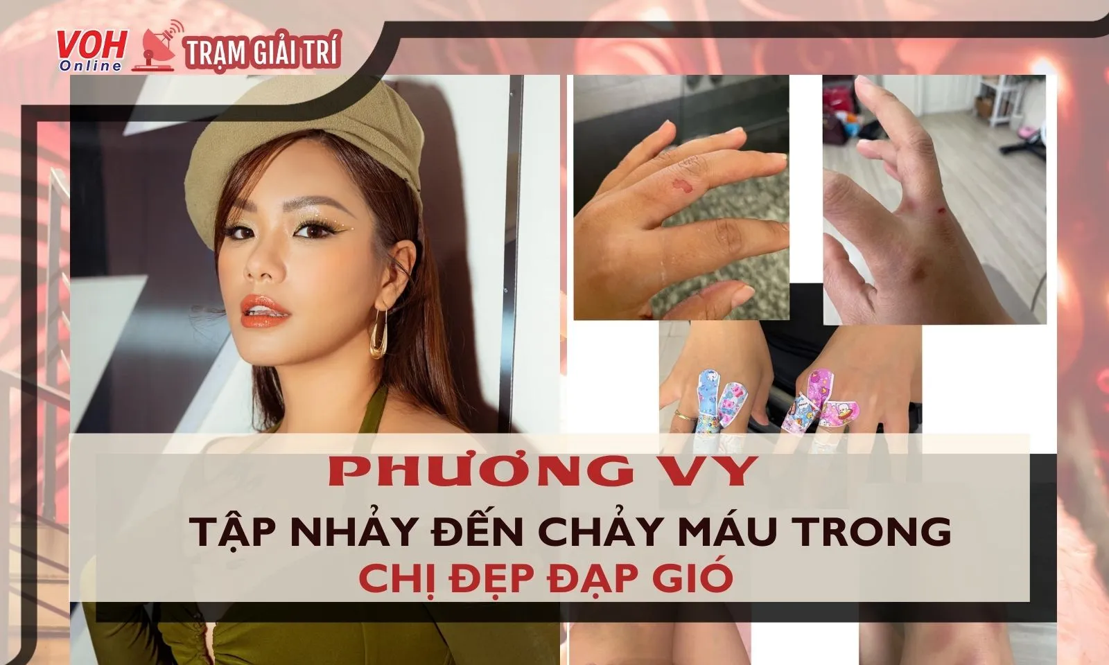 Phương Vy trầy da khắp tay, chân bầm tím vì tập luyện Chị Đẹp