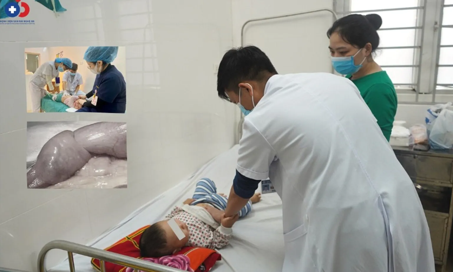 Gia tăng tình trạng trẻ mắc bệnh lồng ruột khi thời tiết lạnh