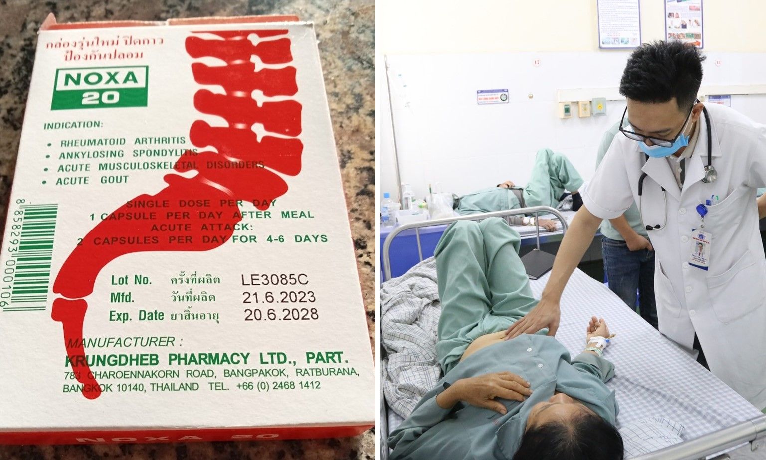 Tự ý dùng thuốc lạ của nước ngoài, bệnh nhân xuất huyết tiêu hóa nặng