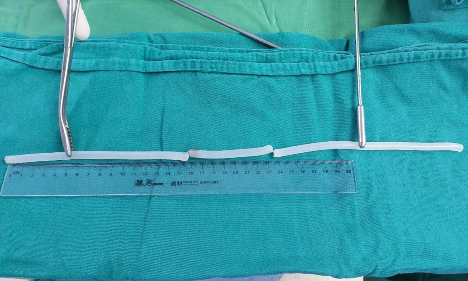Bác sĩ toát mồ hôi cứu người đàn ông nhét keo nến 40 cm vào niệu đạo để tạo khoái cảm