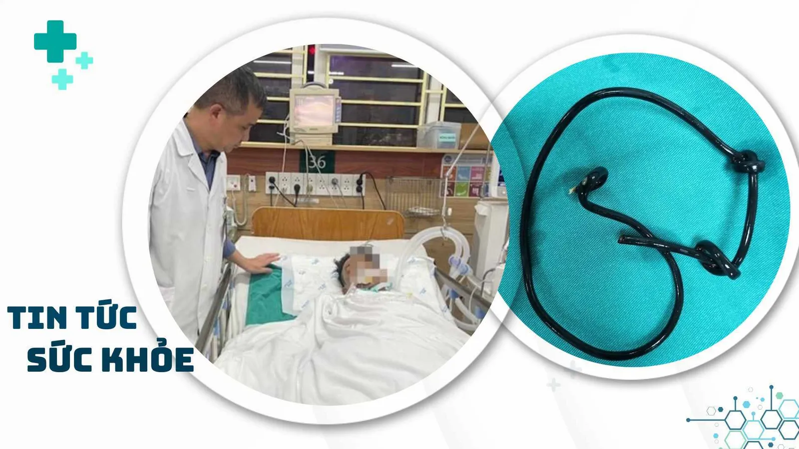 Nhịp Sống Khỏe 14/1: Nhập viện vì nhét dây điện vào đường tiểu | Mạo danh Sở Y tế TPHCM lợi dụng lòng tin người bệnh