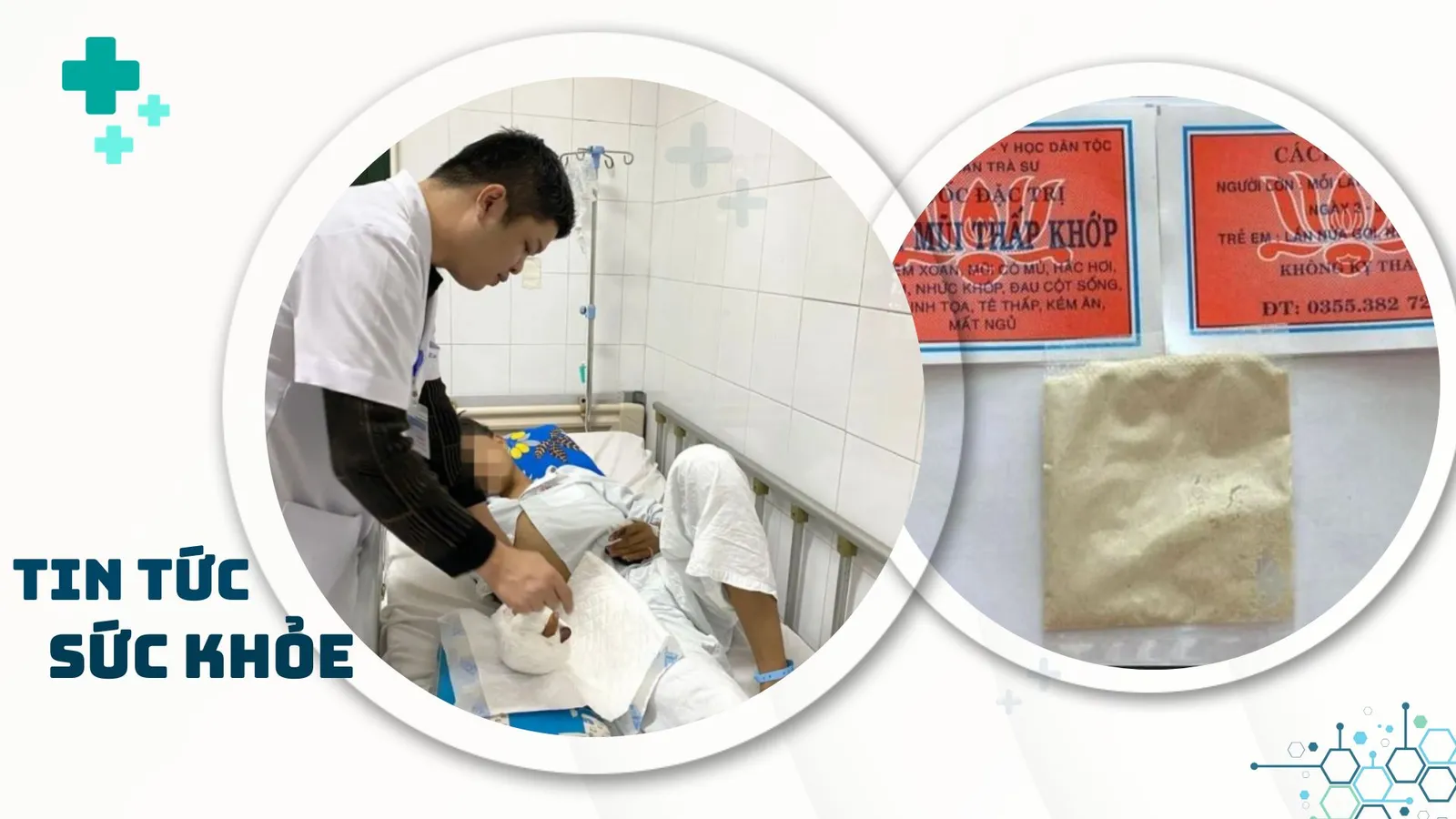 Nhịp Sống Khỏe 15/1: Người trẻ bị suy thận ngày càng nhiều | Suýt chết vì mua thuốc trên mạng xã hội