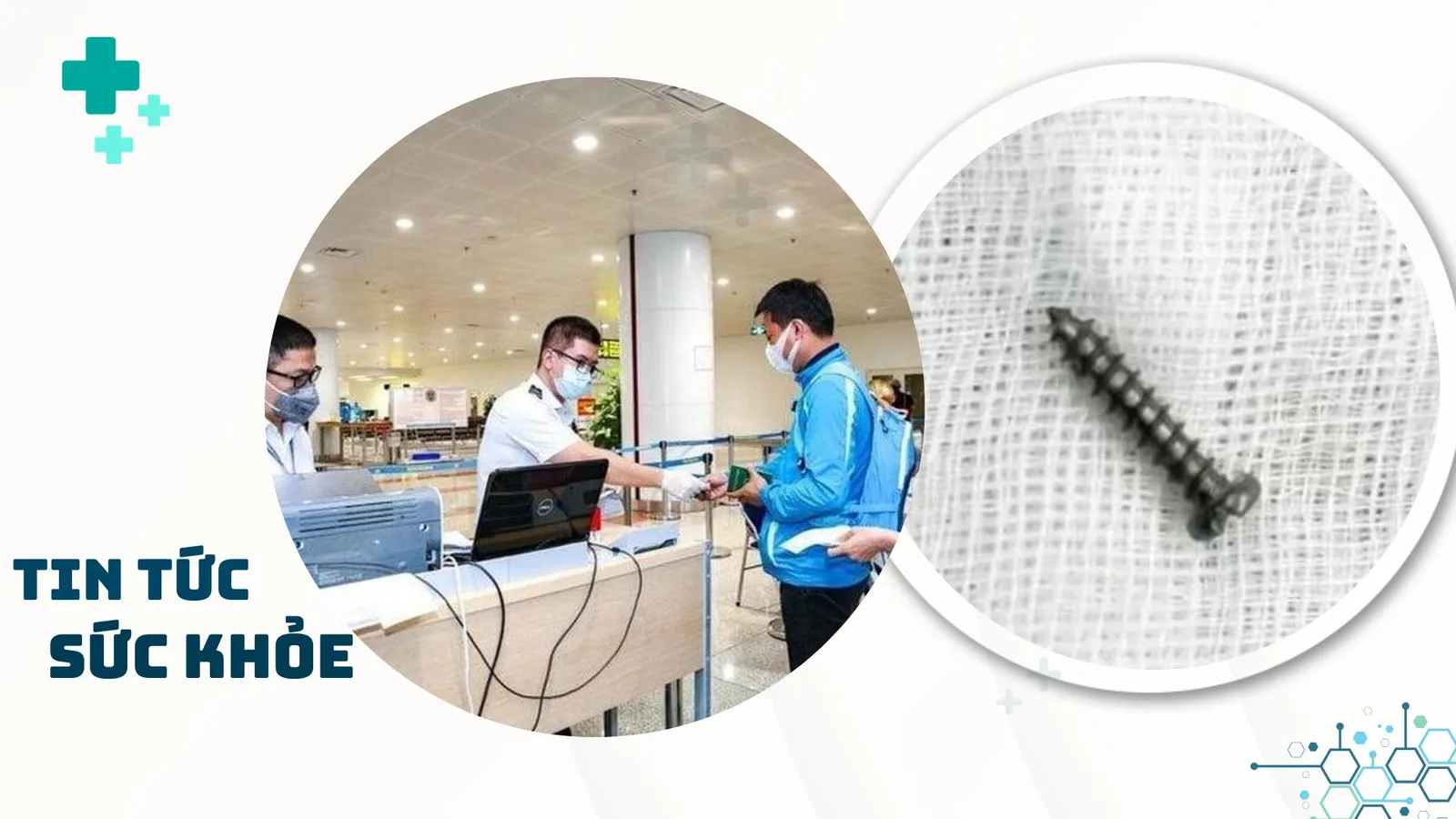 Nhịp Sống Khỏe 17/1: Bộ Y tế yêu cầu tăng cường công tác phòng chống dịch | Mất thị lực sau tiêm filler làm đẹp