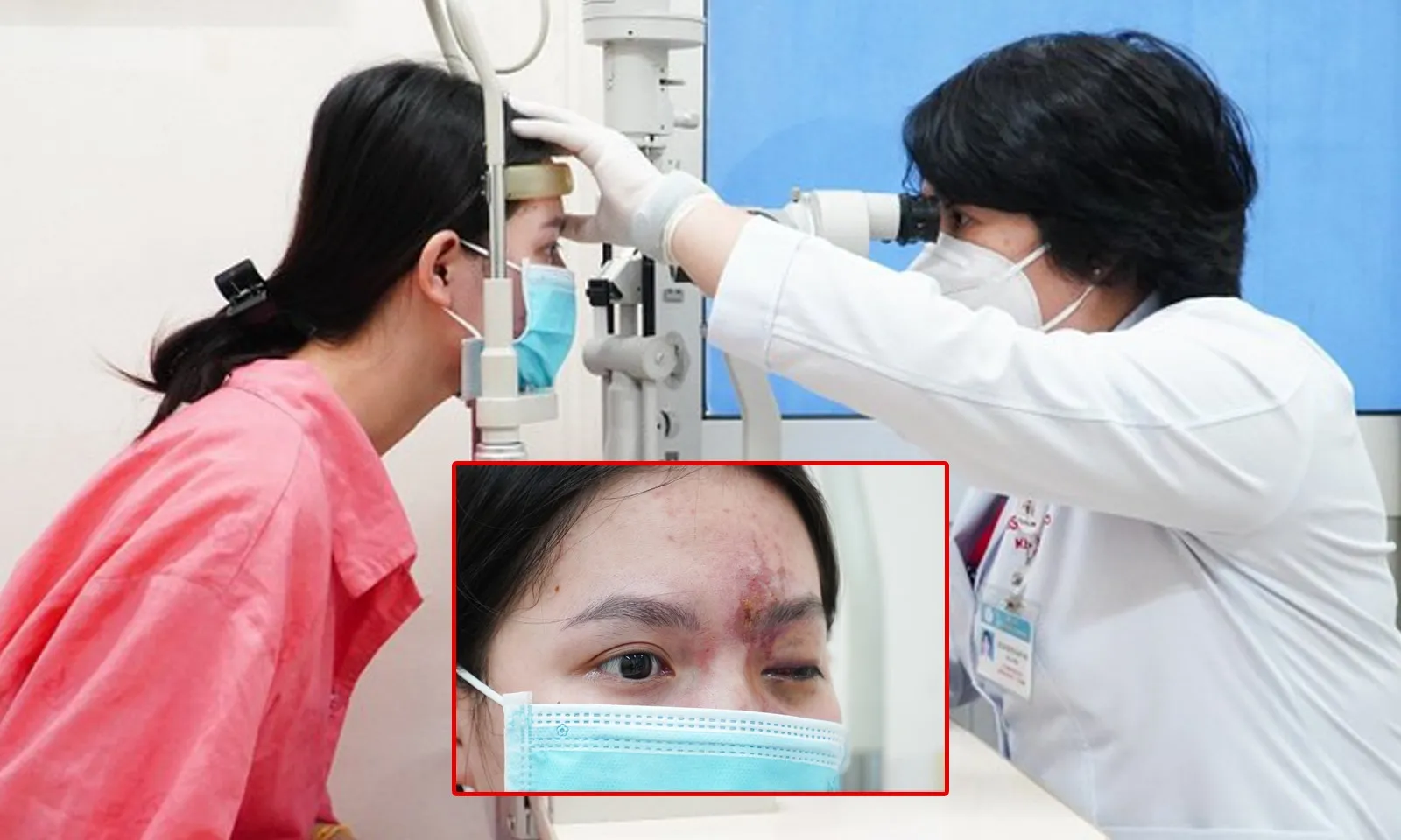 Thiếu nữ 17 tuổi bị mù sau khi tiêm filler