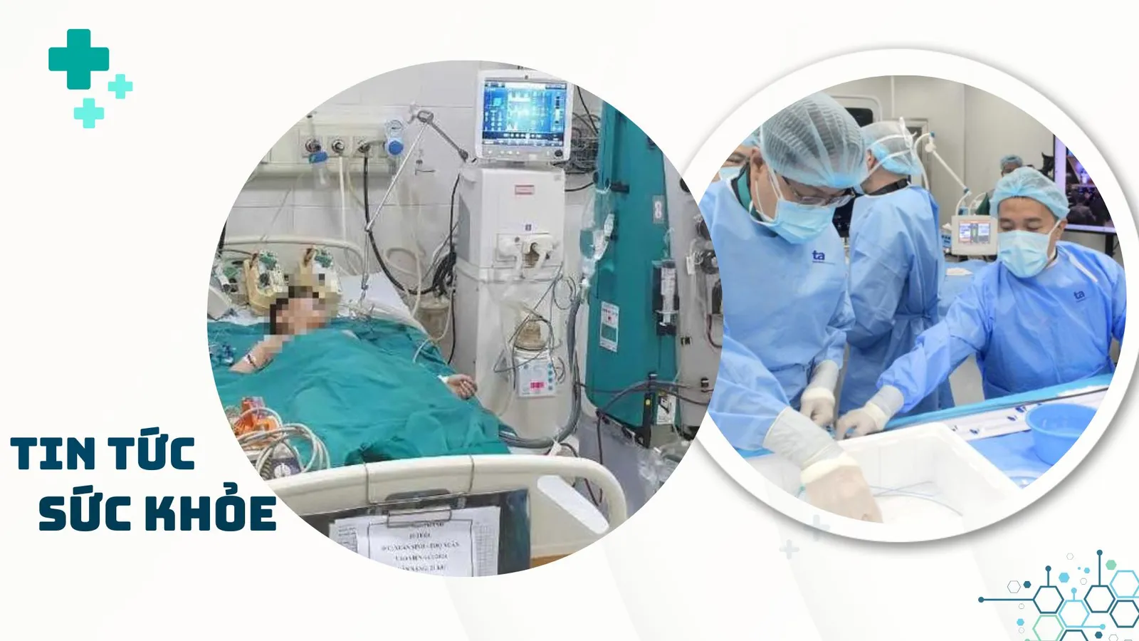 Nhịp Sống Khỏe 21/1: Thực hiện thông tim can thiệp trước chuyên gia quốc tế | Ung thư vú ngày càng trẻ hóa