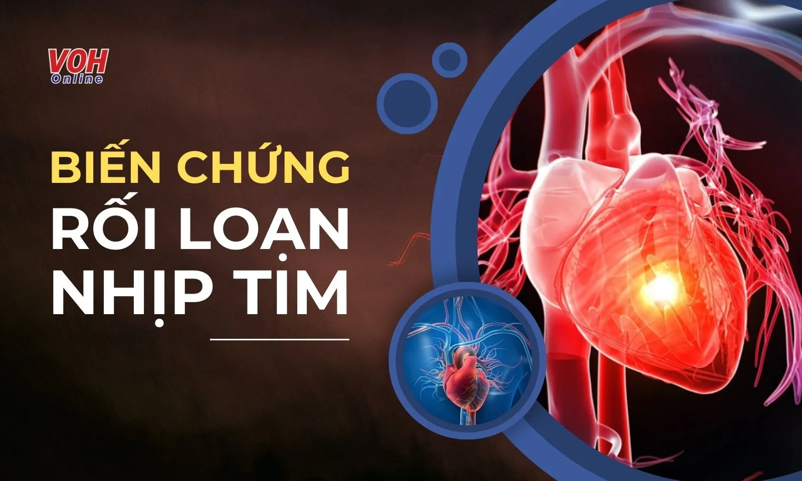 Những biến chứng nguy hiểm của rối loạn nhịp tim