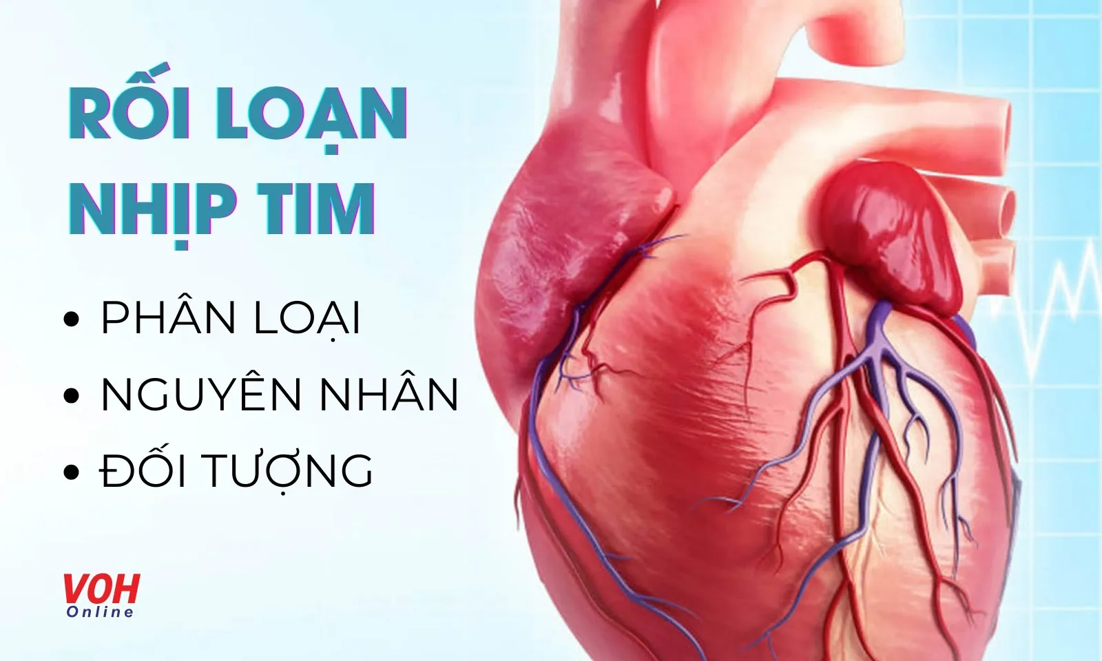 Nguyên nhân nào dẫn đến tình trạng rối loạn nhịp tim?