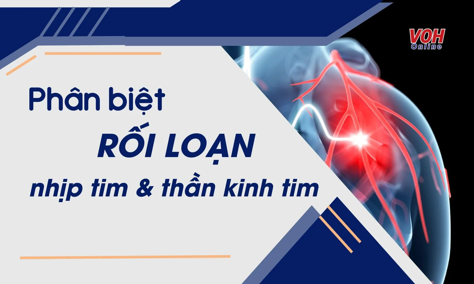 Cách phân biệt rối loạn nhịp tim và rối loạn thần kinh tim