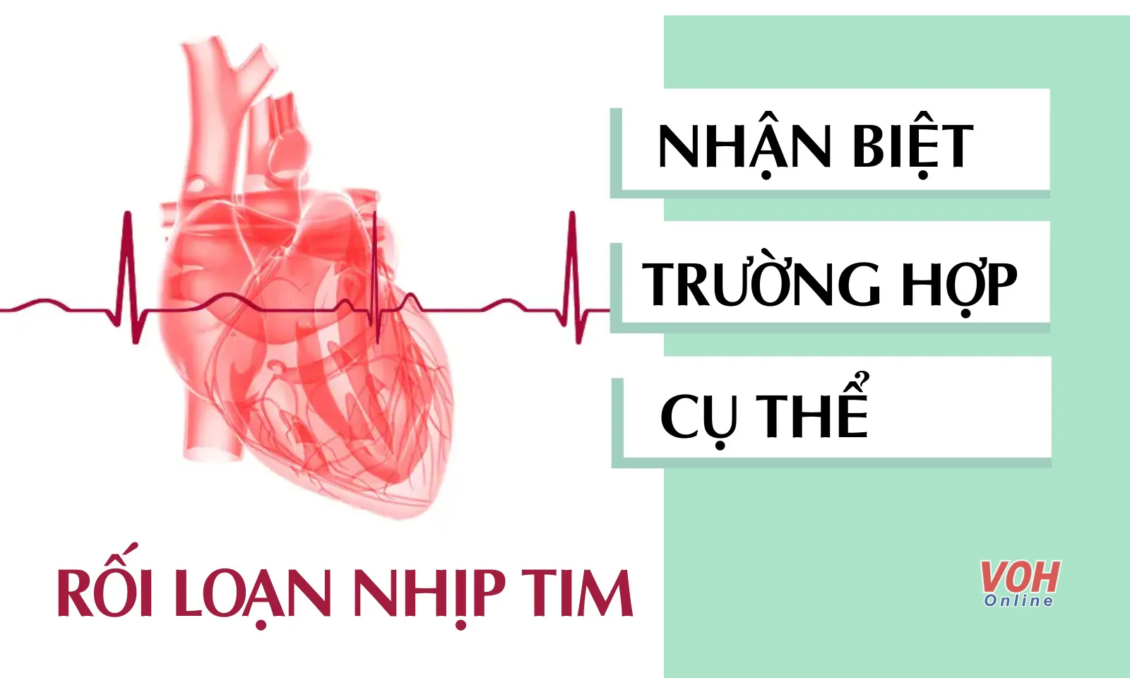 Nhận biết rối loạn nhịp tim qua các trường hợp cụ thể